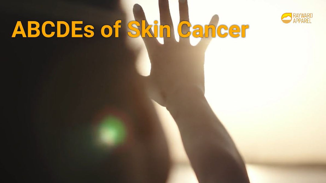 The ABCDEs of Skin Cancer: What You Need to Know